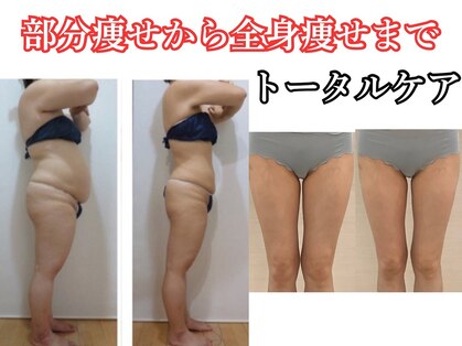 デイスパ ヴィータの写真