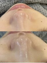 リフレッシュサロンキュア/超音波によるディープ洗浄