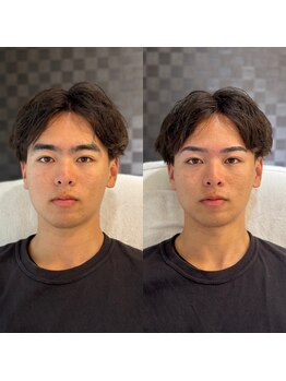 リノアス 上野店(LinoaS)/Before→after