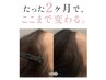 育毛促進プログラム¥45,000【初回価格¥40,000】