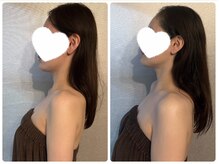 ビノスビューティー(vinos.beauty)/巻き肩矯正　小倉エステ