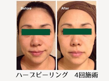 フアリト 江坂店(Fuari-to)/Before After6