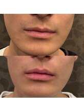 フェリーバ(FELIVA)/お肌革命