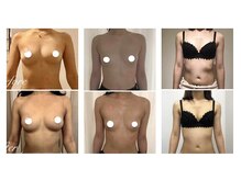 スマイルクルー(SmileClue)/ビフォーアフター症例