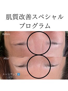 エリア(area.)/16、【肌質改善プログラム】
