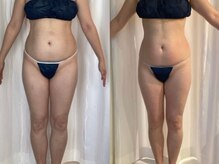 ジョーヌ(JAUNE)/１回でもスッキリ薄いボディへ