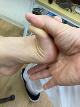 東秩父みすぎ整体院/浮き指