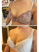 美人バスト 新宿店/☆姉妹店バストアップ症例写真☆