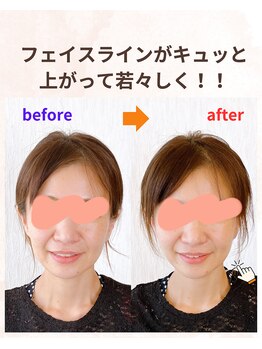 カオノツボ(kaonotubo)/小顔のリフレ80分初回