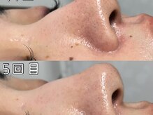 ニコ アンド キャンディー(Nico.&Candy)/毛穴も小さく肌トーンアップ♪