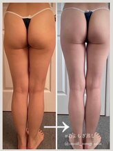 マロカ(Marroka)/【若よもぎ蒸しボディCの結果6】