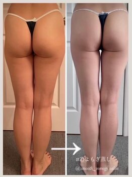 マロカ(Marroka)/【若よもぎ蒸しボディCの結果6】