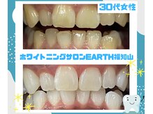 ホワイトニングサロン アース 福知山店(EARTH)の雰囲気（【30代女性】40分×10回照射 目に見えて白さを実感！！）