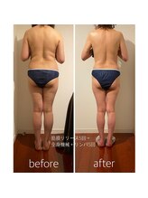 バンブー(bamboo)/ビフォーアフター