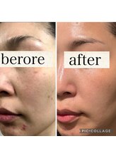 リープ(Lieb)/リアボーテ、目黒フェイシャル