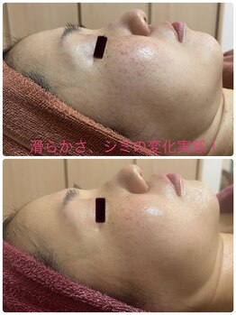 エステサロン エレガンス/