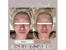 ブーケ(Bouquet)