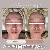ブーケ(Bouquet)