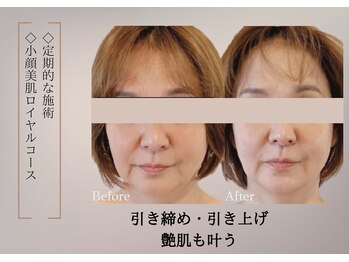 ベラ 東京院(Bella)/年齢悩みにしっかりアプローチ