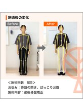 ただき接骨院 整体院 高崎本院/お悩み：骨盤開き、ぽっこりお腹