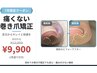 【巻き爪矯正フット】巻き爪施術+一色塗り仕上げお試し¥9,900