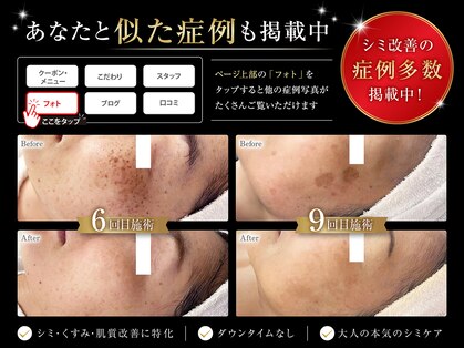 オービーエム 福岡天神三越店(O.B.M)の写真