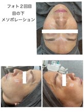 サロンドティアラ(Salon de Tiara)/フォト＋メソポレーション