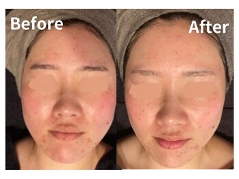 サロン デ ミロ(Salon de Miro)/BeforeAfter多数！ブログへGO♪