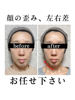 キュープ 群馬吉岡店(Qpu)/お顔の歪みも整えます！骨格矯正