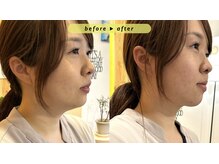 エヴァ ナゴヤ(EVA nagoya)の雰囲気（小顔や顔・あごのたるみにお悩みの方はぜひご相談ください！）