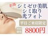 【シミケア人気NO1】平日ご来店お得★シミ改善特許マシン光フォト全顔8,800円