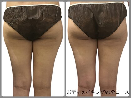 リコ(Relaxation Boutique LICO)の写真