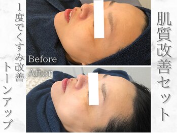 ネオファースト(NeoFirst)の写真/子育てママや働く女性が更に輝けるライフスタイルのお手伝い♪【外苑前駅徒歩3分★口コミ高評価】