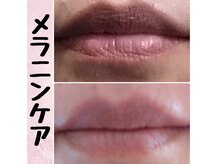 サロンローズ(Salon Rose)