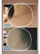 マシェリ(Macherie)/ゆらぎ肌におすすめ