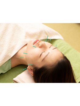 鍼灸施術を受けたい