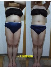 シンシア(SINCERE)/上半身シェイプ付き全身リンパ