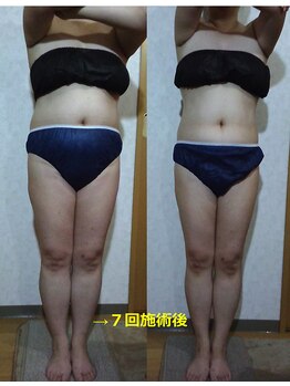シンシア(SINCERE)/上半身シェイプ付き全身リンパ