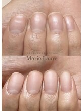 マリーロール 天王寺店(Marie Laure)/自爪育成/深爪矯正/ネイルケア