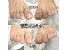 リーシュ 所沢店(RICHE)/フットケア