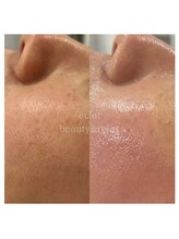 エクラ(eclat)/次世代ハーブトリートメント