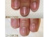 ★深爪矯正・自爪育成・爪トラブル★【最強のネイルケア3ヵ月8回コース】