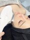 サロン ド ビューティージュエル(salon de beauty JEWEL)の写真/【業界初11枚フィルター】お肌のザラつきや繰り返すニキビにお悩みの方へ！”光フェイシャル”で根本改善◎