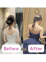 ボディキュア ブライダル美容整体 大阪梅田/肩の盛り上がり解消！/梅田