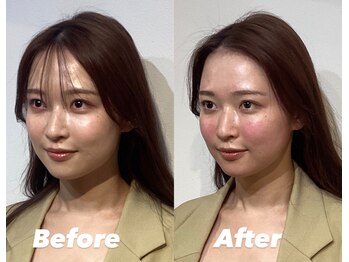 コルミチョン サロン(骨美整 salon)/左右非対称施術　Before・After