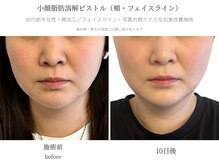 サボラミ(sabor A Mi)/左右差のお悩みもお任せ下さい♪