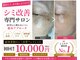 ソワラ(Soiela)の写真