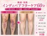 <術前/術後インディバアフターケア60分> 硬さ改善/DT短縮/皮膚凸凹/色味回復