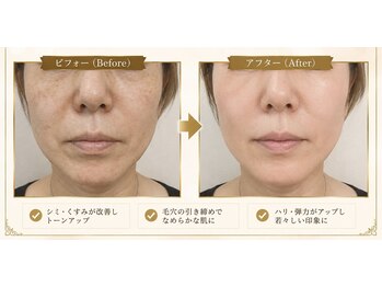 ラシクビューティールームの写真/シミ・くすみが気になる大人女性へ。初めての肌ケアもお気軽に