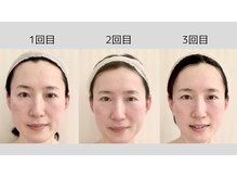 エスツリービューティーアンドネイル(S-TREE BEAUTY&NAIL)の雰囲気（専門家厳選のメニューを多数ご用意♪施術効果はブログにて★）